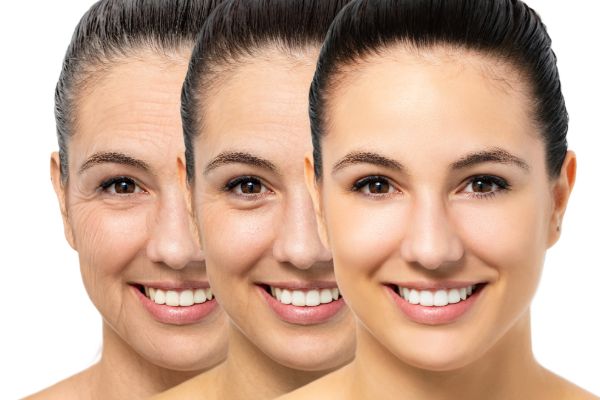 anti-aging skin treatment showing younger looking skin